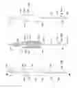 Fig. 44 - System for intra-abdominally moving an organ