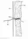 Fig. 01 - METHOD AND APPARATUS FOR TRANSAPICAL ACCESS AND CLOSURE