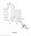 Fig. 08 - METHOD AND APPARATUS FOR TRANSAPICAL ACCESS AND CLOSURE