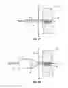 Fig. 10 - METHOD AND APPARATUS FOR TRANSAPICAL ACCESS AND CLOSURE
