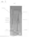 Fig. 09 - Absorbable surgical fasteners for securing prosthetic devices to tissue