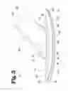 Fig. 06 - Vascular anastomosis device and method