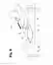 Fig. 09 - Vascular anastomosis device and method