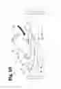 Fig. 11 - Vascular anastomosis device and method