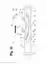 Fig. 12 - Vascular anastomosis device and method