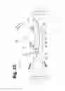 Fig. 13 - Vascular anastomosis device and method