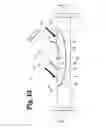 Fig. 14 - Vascular anastomosis device and method