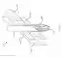 Fig. 17 - Sutureless vascular anastomosis connection