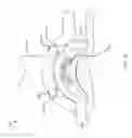 Fig. 27 - Sutureless vascular anastomosis connection