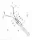 Fig. 02 - Device and method for through the scope endoscopic hemostatic clipping