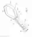 Fig. 03 - Device and method for through the scope endoscopic hemostatic clipping