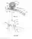 Fig. 03 - CATHETER TIP TO AID FILAMENT DELIVERY