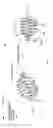 Fig. 03 - Nitinol occlusion plug