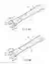 Fig. 12 - Probe, treatment device, and treatment system