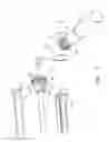 Fig. 03 - Detachable orthopaedic reamer handle