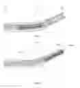 Fig. 02 - WINDOWED INSTRUMENT DRILL GUIDE AND CORRESPONDING FRICTION REDUCING INSTRUMENT