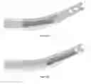 Fig. 05 - WINDOWED INSTRUMENT DRILL GUIDE AND CORRESPONDING FRICTION REDUCING INSTRUMENT