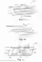 Fig. 09 - CURETTE HEAD AND METHODS OF USE THEREOF