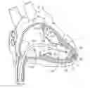 Fig. 01 - Delivery system assemblies for implantable medical devices