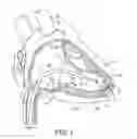 Fig. 02 - Delivery system assemblies for implantable medical devices