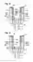 Fig. 08 - POLYAXIAL BONE ANCHORING DEVICE