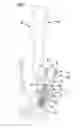 Fig. 03 - Pedicle screw system and spinal stabilization system