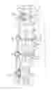 Fig. 01 - Spinal correction system actuators