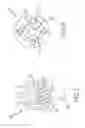 Fig. 06 - Spinal correction system actuators
