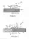 Fig. 25 - Spinal correction system actuators