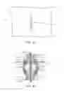 Fig. 06 - METHODS AND APPARATUS FOR COUPLING A PROSTHESIS TO A SPINAL SEGMENT