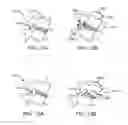 Fig. 28 - METHODS AND APPARATUS FOR COUPLING A PROSTHESIS TO A SPINAL SEGMENT