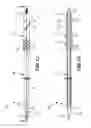 Fig. 03 - Method and apparatus for joint fusion