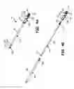Fig. 08 - Method and apparatus for joint fusion