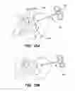Fig. 20 - Method and apparatus for joint fusion