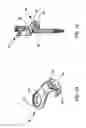Fig. 10 - Laminar hook insertion device