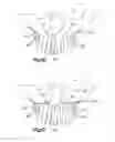 Fig. 10 - Orthognathic implant and methods of use