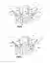 Fig. 12 - Orthognathic implant and methods of use