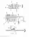 Fig. 15 - Orthognathic implant and methods of use