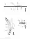 Fig. 16 - Orthognathic implant and methods of use