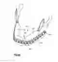 Fig. 20 - Orthognathic implant and methods of use