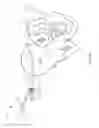 Fig. 09 - Screw for joint fusion