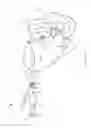 Fig. 10 - Screw for joint fusion