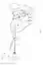 Fig. 15 - Screw for joint fusion