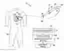 Fig. 01 - Systems and methods for cleaning medical device electrodes