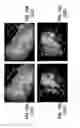 Fig. 11 - Computer-aided planning of liver surgery