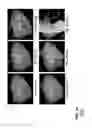 Fig. 15 - Computer-aided planning of liver surgery