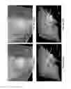 Fig. 21 - Computer-aided planning of liver surgery