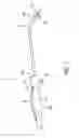 Fig. 02 - DEVICE AND METHOD FOR CONNECTING A MEDICAL INSTRUMENT TO A POSITION-DETECTING SYSTEM