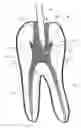 Fig. 01 - Methods and Devices for Treating Root Canals of Teeth