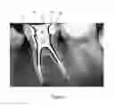 Fig. 03 - Methods and Devices for Treating Root Canals of Teeth